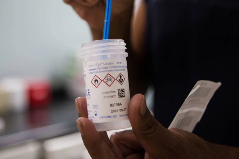 Teste de HPV no sangue menstrual mostra sensibilidade semelhante ao exame clínico em estudo com 3.068 mulheres, abrindo possibilidade para ampliar rastreamento